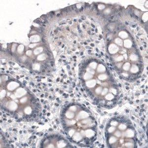 Monoclonal Anti-CEP350 antibody produced in mouse 