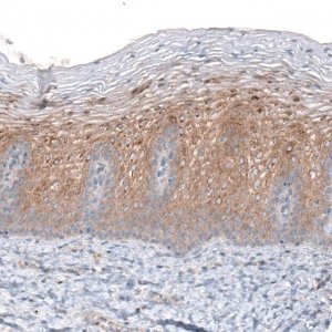 Monoclonal Anti-CLIP1 antibody produced in mouse 