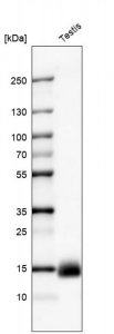 Monoclonal Anti-CTAG1B antibody produced in mouse AMAB91606-100UL