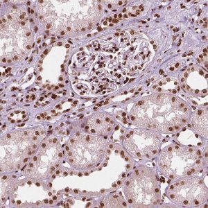 Monoclonal Anti-CTCF antibody produced in mouse 