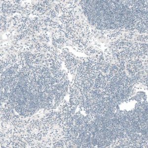 Monoclonal Anti-CTGF antibody produced in mouse 