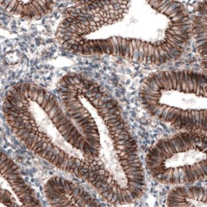 Monoclonal Anti-CTNNB1 antibody produced in mouse 