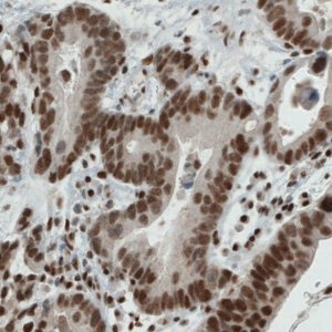 Monoclonal Anti-ERCC1 antibody produced in mouse 