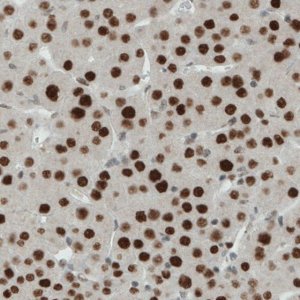 Monoclonal Anti-ERCC1 antibody produced in mouse 