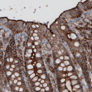 Monoclonal Anti-EZR antibody produced in mouse 