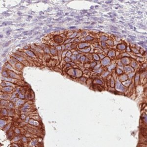 Monoclonal Anti-HER2 antibody produced in mouse 