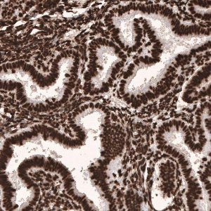 Monoclonal Anti-HIST1H3A antibody produced in mouse 
