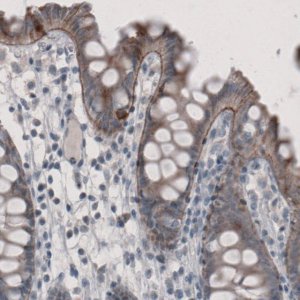 Monoclonal Anti-LAMA3 antibody produced in mouse 
