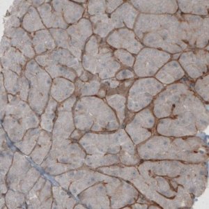 Monoclonal Anti-LAMB1 antibody produced in mouse 