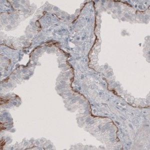 Monoclonal Anti-LAMB3 antibody produced in mouse 
