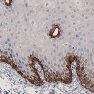 Monoclonal Anti-LAMB3 antibody produced in mouse 