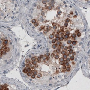 Monoclonal Anti-LY6K antibody produced in mouse 