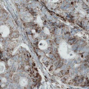 Monoclonal Anti-MACC1 antibody produced in mouse 