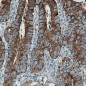 Monoclonal Anti-MACC1 antibody produced in mouse 