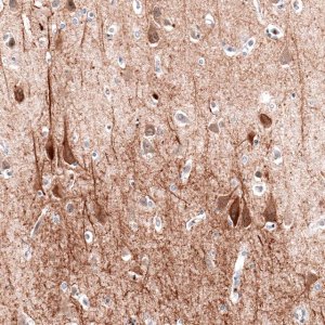 Monoclonal Anti-MAP2 antibody produced in mouse 