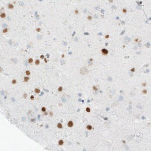 Monoclonal Anti-MEF2C antibody produced in mouse 