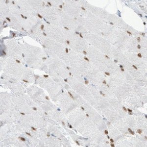 Monoclonal Anti-MEF2C antibody produced in mouse 