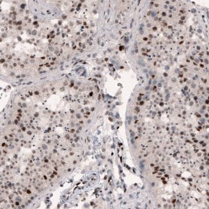 Monoclonal Anti-METTL14 antibody produced in mouse 