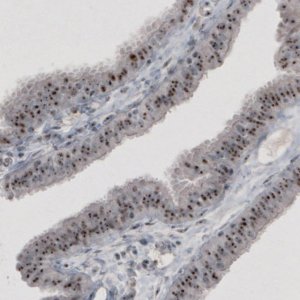 Monoclonal Anti-MKI67IP antibody produced in mouse 
