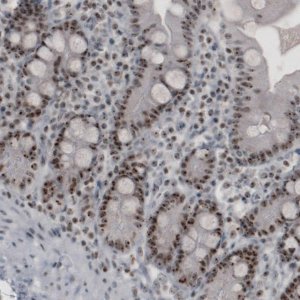 Monoclonal Anti-MKI67IP from mouse 