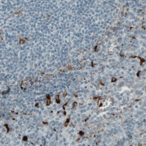 Monoclonal Anti-MMP9 antibody produced in mouse 