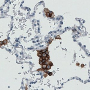 Monoclonal Anti-MRC1 antibody produced in mouse 