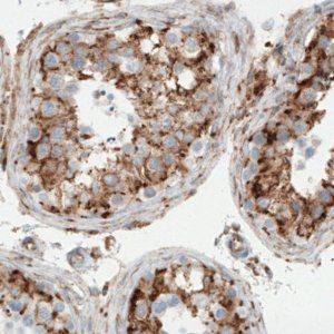 Monoclonal Anti-MTDH antibody produced in mouse 