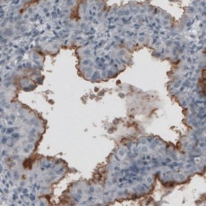 Monoclonal Anti-MUC16 antibody produced in mouse 