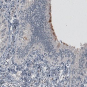 Monoclonal Anti-MUC16 antibody produced in mouse 