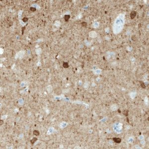Monoclonal Anti-NECAB1 antibody produced in mouse 