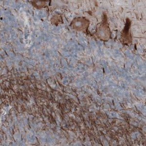 Monoclonal Anti-NEFH antibody produced in mouse 