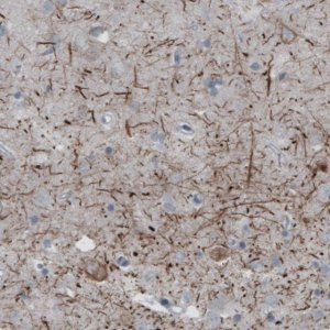 Monoclonal Anti-NEFH antibody produced in mouse 