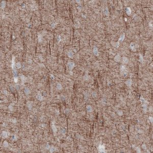 Monoclonal Anti-NEFL antibody produced in mouse 