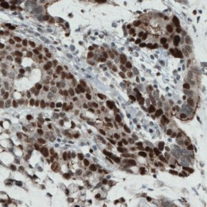 Monoclonal Anti-NSD2 antibody produced in mouse 