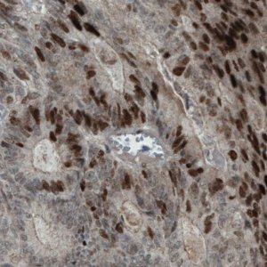 Monoclonal Anti-NSD2 antibody produced in mouse 