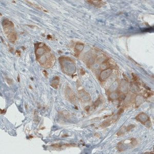 Monoclonal Anti-PHGDH antibody produced in mouse 