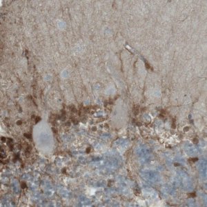 Monoclonal Anti-PHGDH antibody produced in mouse 