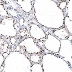Monoclonal Anti-PIK3CB antibody produced in mouse AMAB91585-100UL