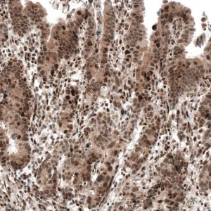 Monoclonal Anti-PIK3CB antibody produced in mouse AMAB91585-100UL