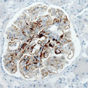 Monoclonal Anti-PLA2R1 antibody produced in mouse 