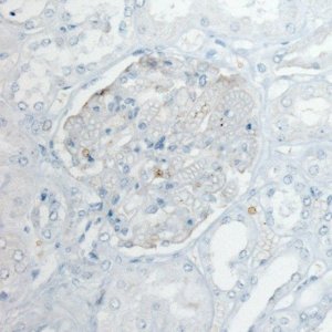 Monoclonal Anti-PLA2R1 antibody produced in mouse 