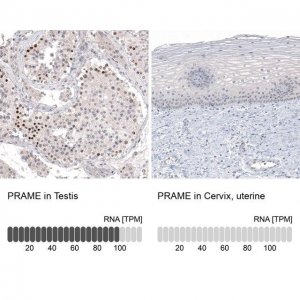 Monoclonal Anti-PRAME antibody produced in mouse 