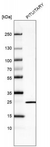 Monoclonal Anti-PRL 