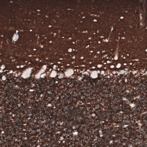 Monoclonal Anti-PRRT2 antibody produced in mouse 