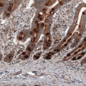 Monoclonal Anti-RBCK1 antibody produced in mouse 