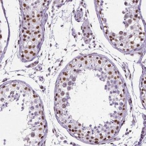 Monoclonal Anti-REST antibody produced in mouse 
