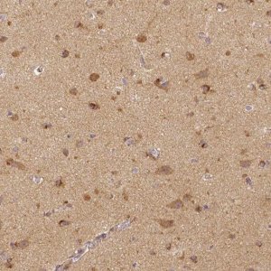 Monoclonal Anti-RHOT1 antibody produced in mouse 