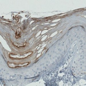 Monoclonal Anti-RNASE7 antibody produced in mouse 