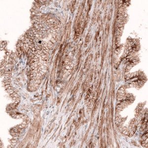 Monoclonal Anti-ROR2 antibody produced in mouse 