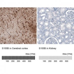 Monoclonal Anti-S100B antibody produced in mouse 